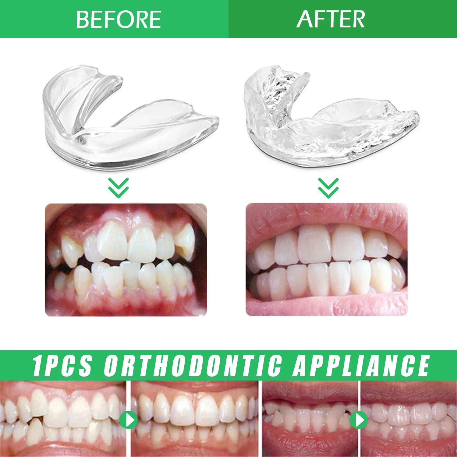 Orthodontics Retainer Teeth Guard Retainers For Teeth Straightening