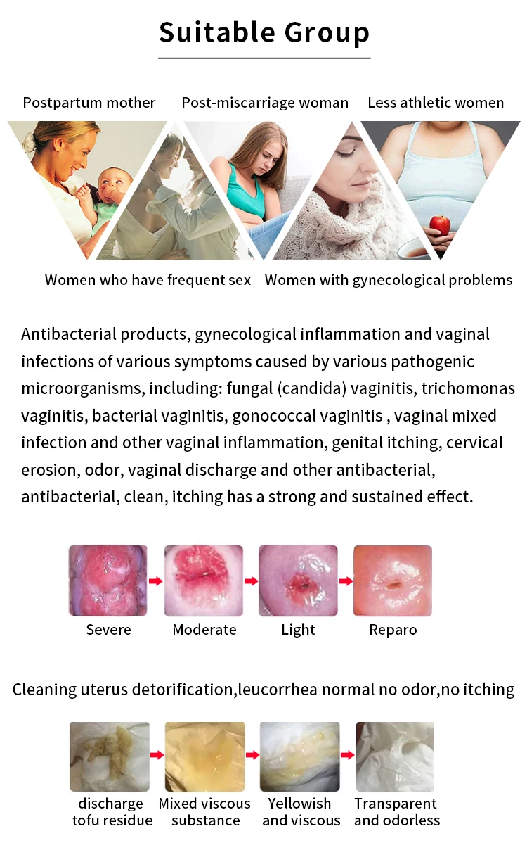 阴道美白清洁中药提取物女性护理消毒软膏