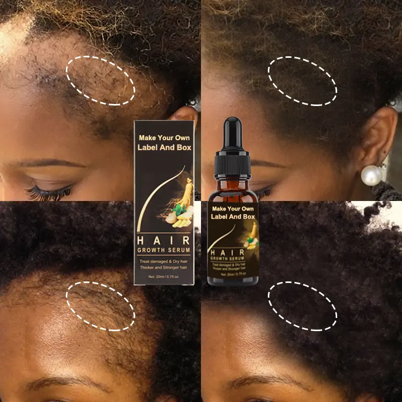 

Custom Logo Nourishing Repairing Anti Loss Regrowth Hair Treatment Scalp Elixirs Private Label Hair Growth Serum Oil