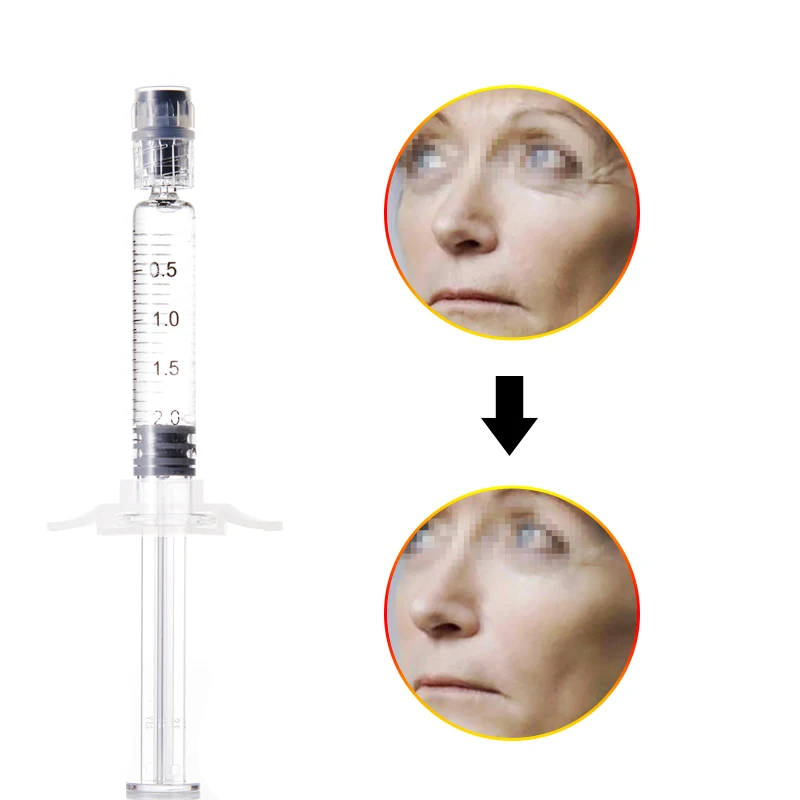 

Deenora professional cross-linked acid hialuron ha gel cheek injectable ha dermal filler for face lips injection