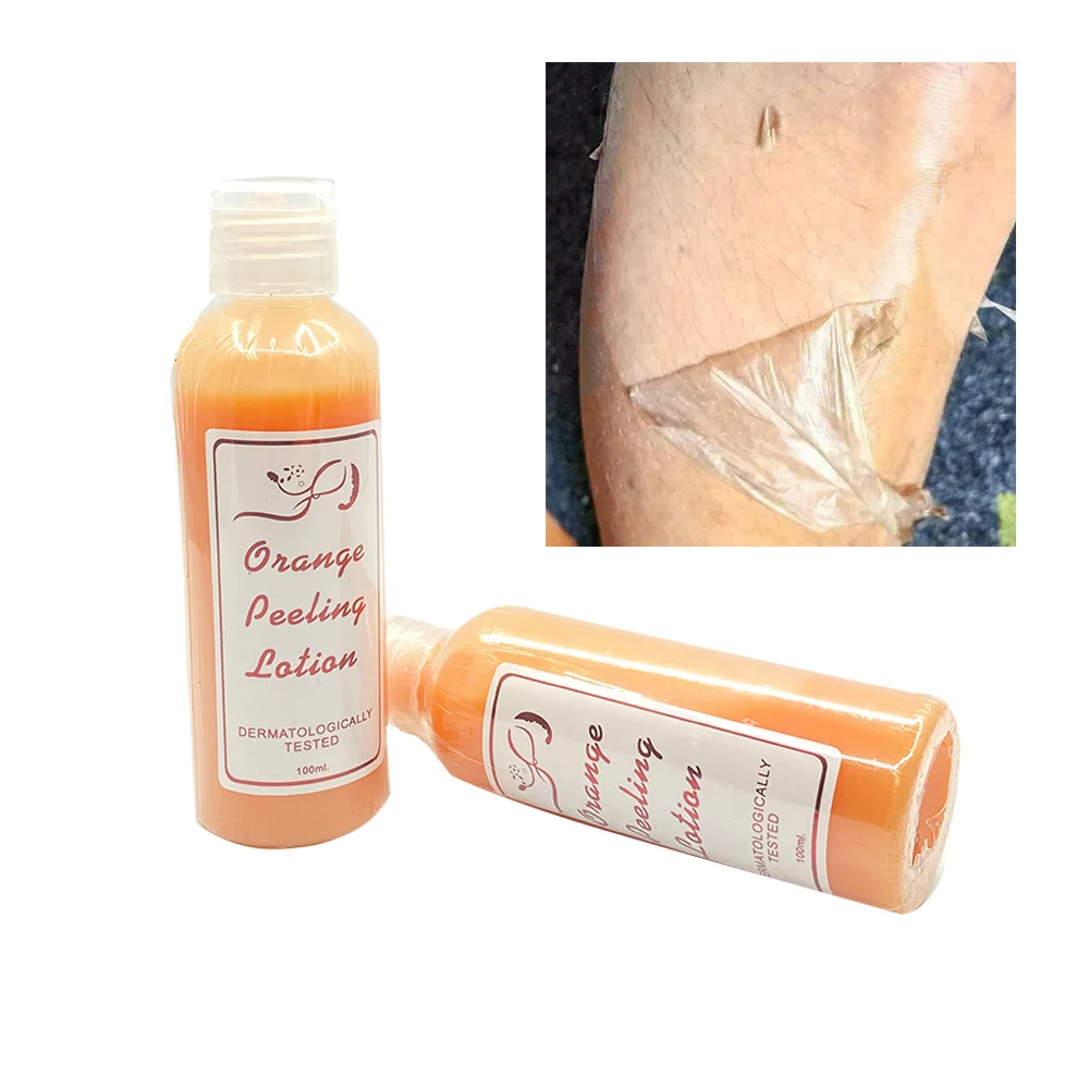 

100ml Skin Care Products Whitening Body Lotion Exfoliating Lightening Organic Orange Peeling Lotion