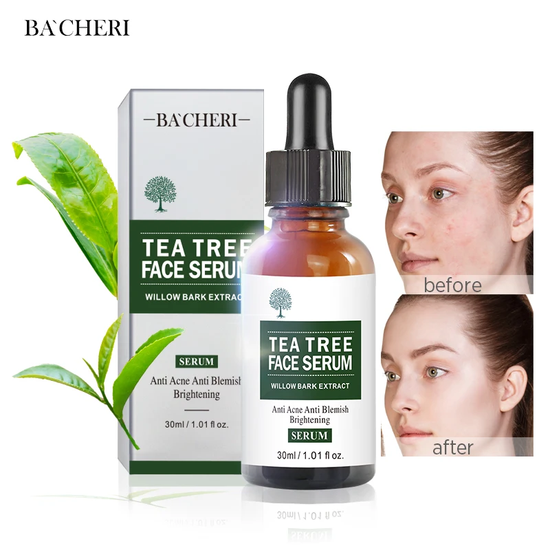 

Private Label Skin Care Natural Organic Tea Tree Brightening Anti Blemish Anti Acne Face Serum