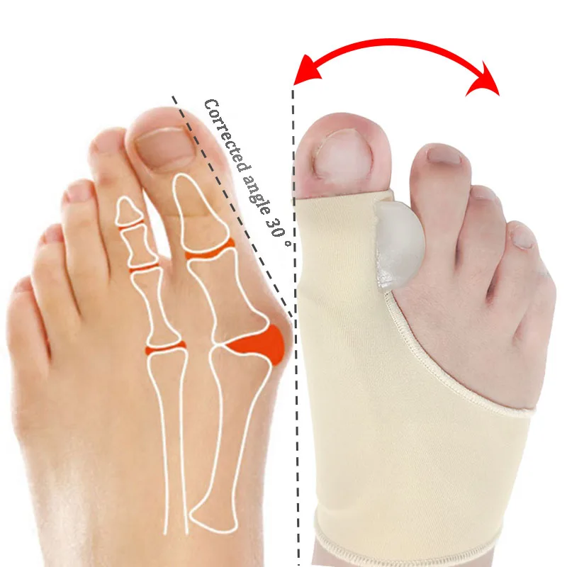 

Bunion Sock Corrector Hallux Valgus Relief Cushion Pads Guard Bunion Sleeve, White, skin