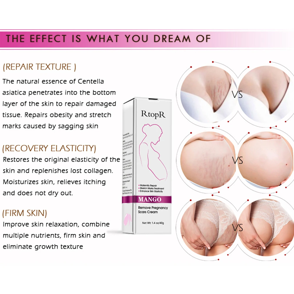High Quality Scar Removal Cream