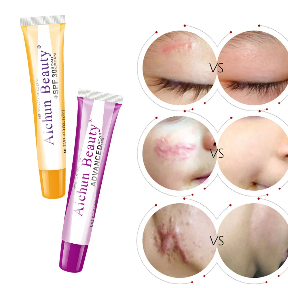 

Natural Face Cream Scar Surgical Scars Acne Marks Treatment Remover Cream