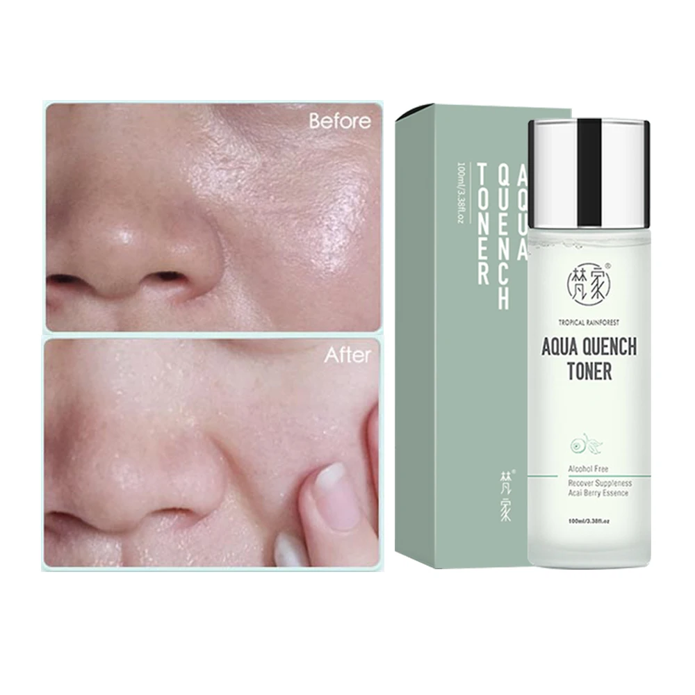 

New Type Toner Adults Facial Skin Care Female  Rainforest High Moisturizing Water Fast delivery within 7 days, As the picture