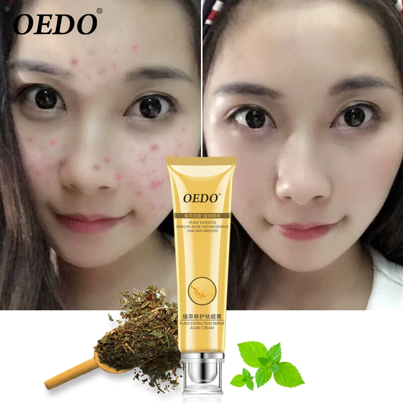 

Plant Extraction Repair Anti Acne Face Cream Ginseng Scutellariae Extract Face Care Acne Scar Treatment Face Cream Whitening 20g