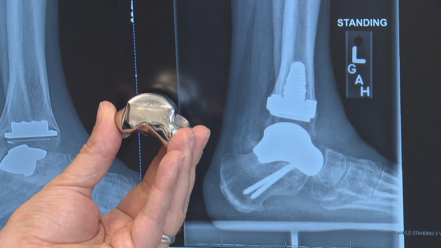 Commercial Pure Cp Titanium Medical Grade Titanium Titan Powder For