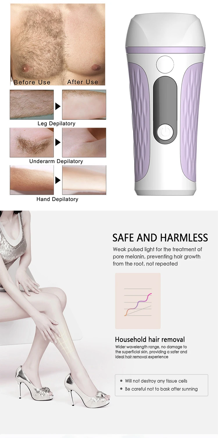 Hair Removal IPL 3.jpg