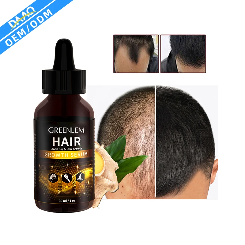

Hot sell Natural organic Promotes Hair Faster Growth Serum Oil For Man And Woman hair growth oil