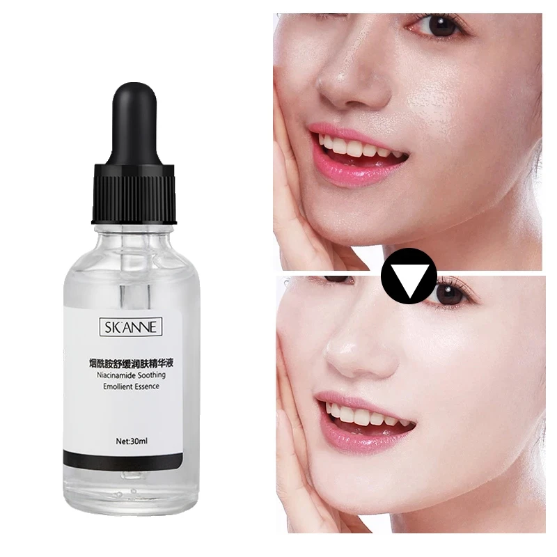 

30ml Nicotinamide Whitening Face Serum Repair Hydrating Moisturizing Lifting Brightening Facial Serum