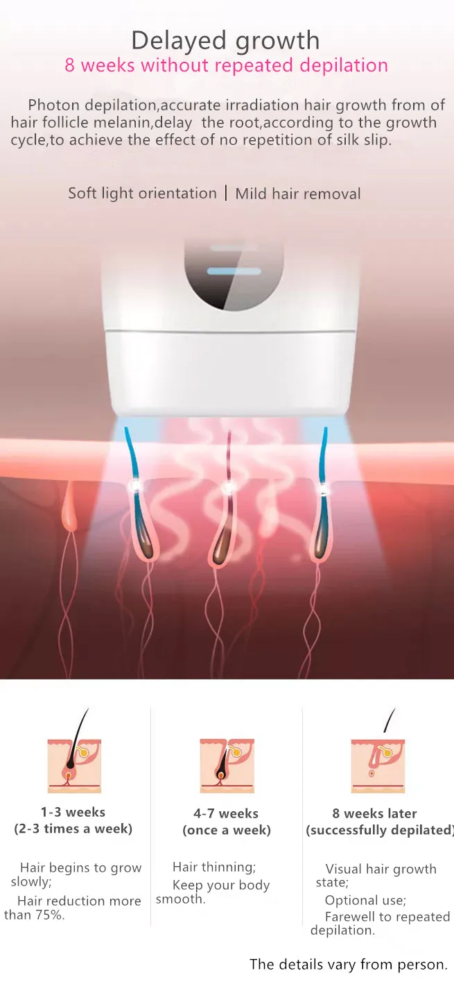 IPL hair removal (10).jpg