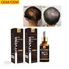 /product-detail/high-profit-margin-products-make-your-label-hair-serum-for-hair-growth-62324025743.html