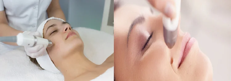 face lift machine skin tightening