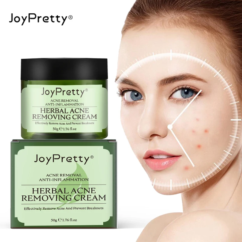 

Private Label Natural Herbal Derma Pure Anti Acne Marks Pimple Spot Removal Skin Care Treatment Face Cream