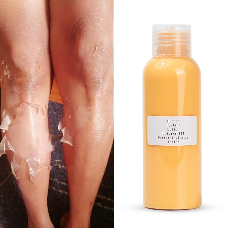 

Private Label Dark Knuckle Yellow Peeling Oil Extra Strength Body to Remove Skin Layer Beauty Body Lotion for Dark Black Skin