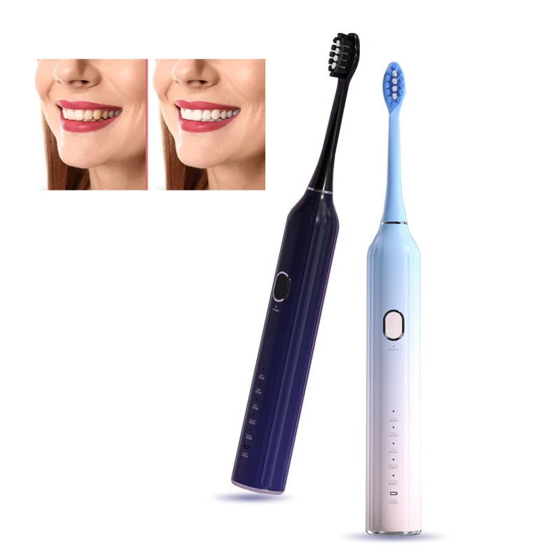 

Dropshipping Escova De Dente Electric Toothbrush Kit Cepillos Dentales Tooth Cleaner Brosse A Dent Smart Automatic Tooth Brush, Pink white