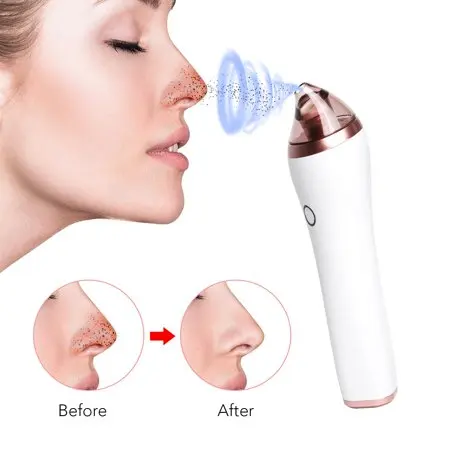 

2021 Newest Blackhead Remover Pore Vacuum Device Home Use