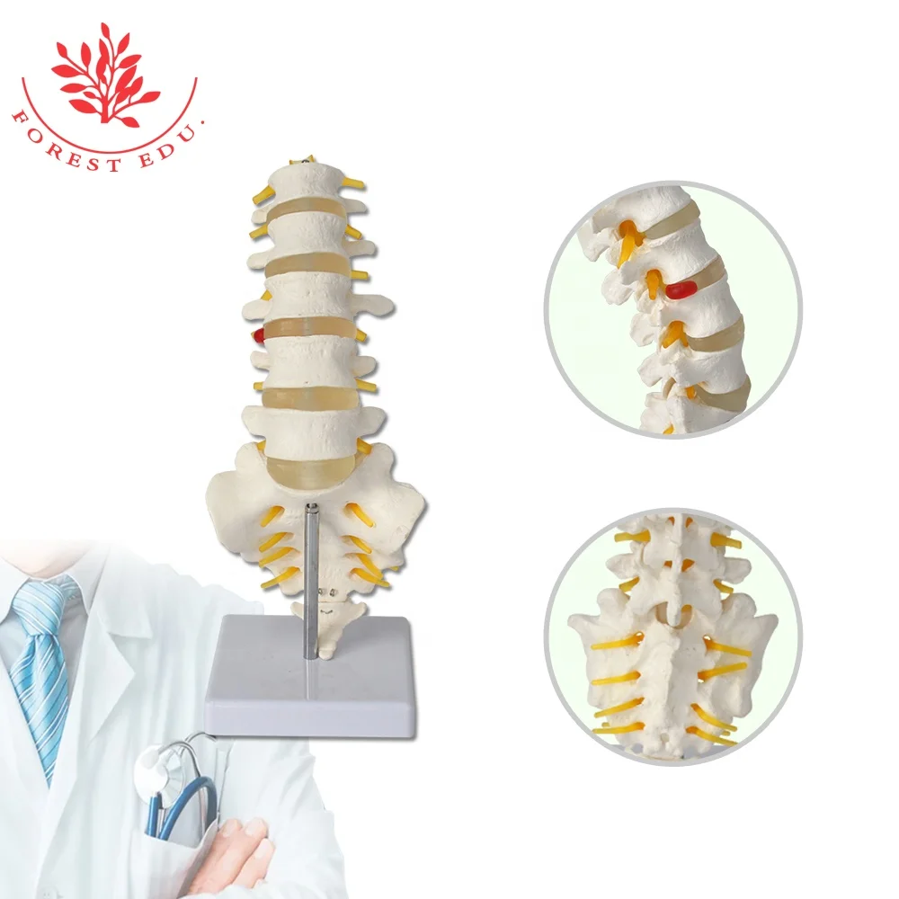 

5 Pieces Vertebra L1-L5 Lumbar Sciatic Branch A Herniated Disc Included Medical Spine Model