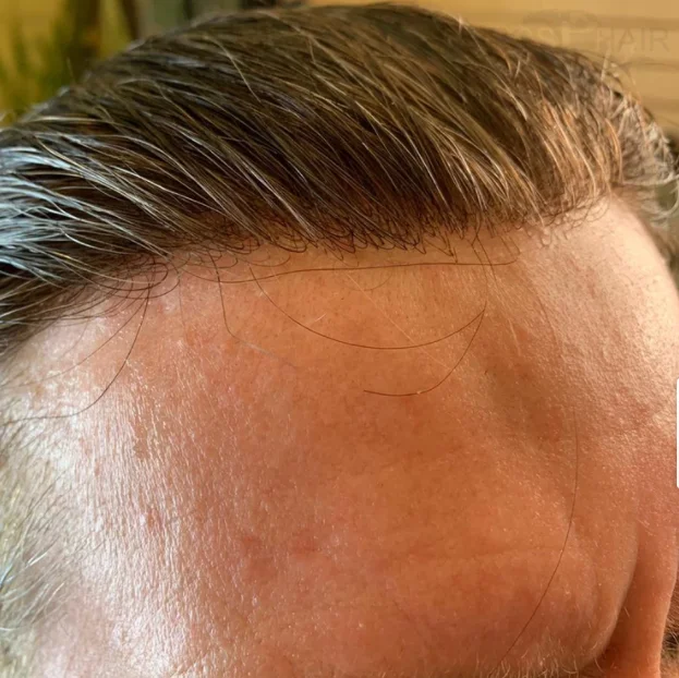 

Factory price high quality men toupee styling products thin skin replacement system real human hair men toupee