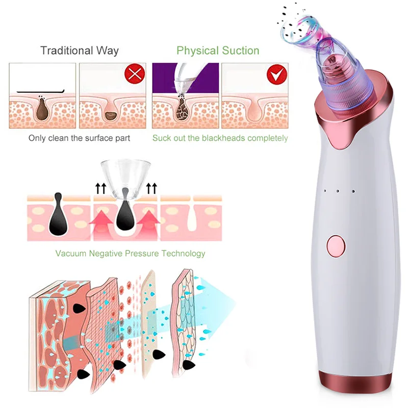 2020 Best Selling 5 In 1 Facial Pore Deep Cleaning Electric Blackhead Remover Vacuum Pore Vacuum Cleaner