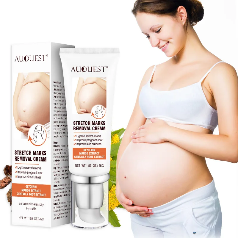 

Stretch Marks Remove Acne Scar Treatment Cream Face Whitening Cream Pimple Scar Pregnancy Nourish Postpartum Body Skin Cream