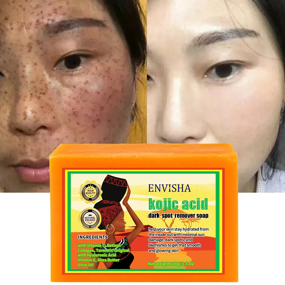 

Natural Organic African Black Soap Acne Treatment Dark Spot Remover Bar Soap