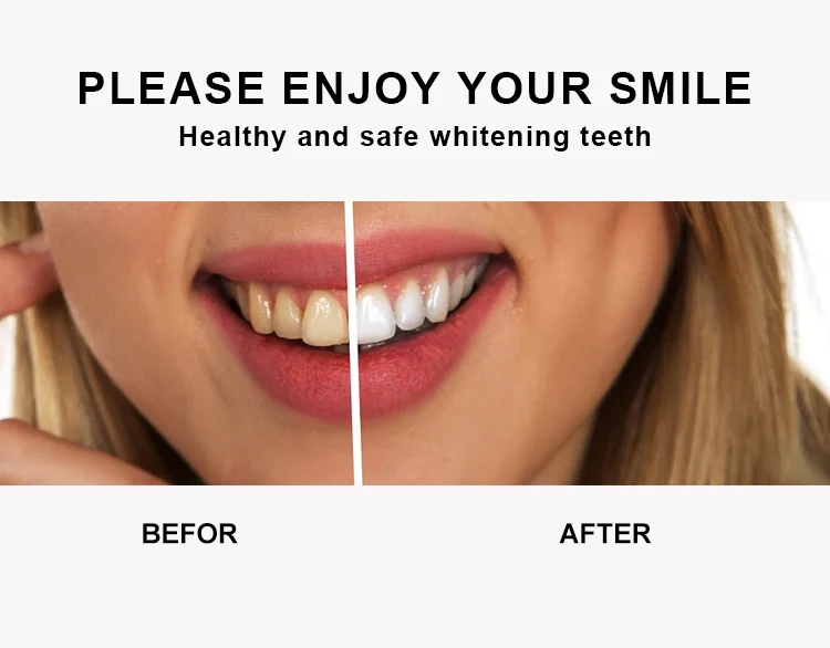 Custom Logo FDA CE Approved Tooth Bleaching Kit LED Light Teeth Whitening Home Kit