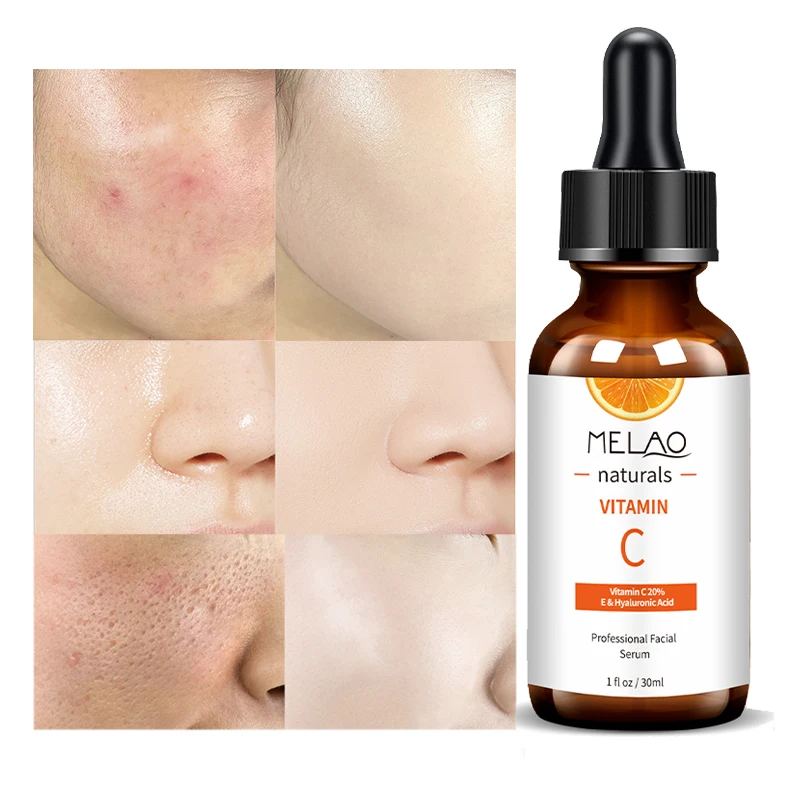 

MELAO natural organic whiten brighten skin smoothing lighten acne transparent anti aging facial whitening hyaluronic acid serum