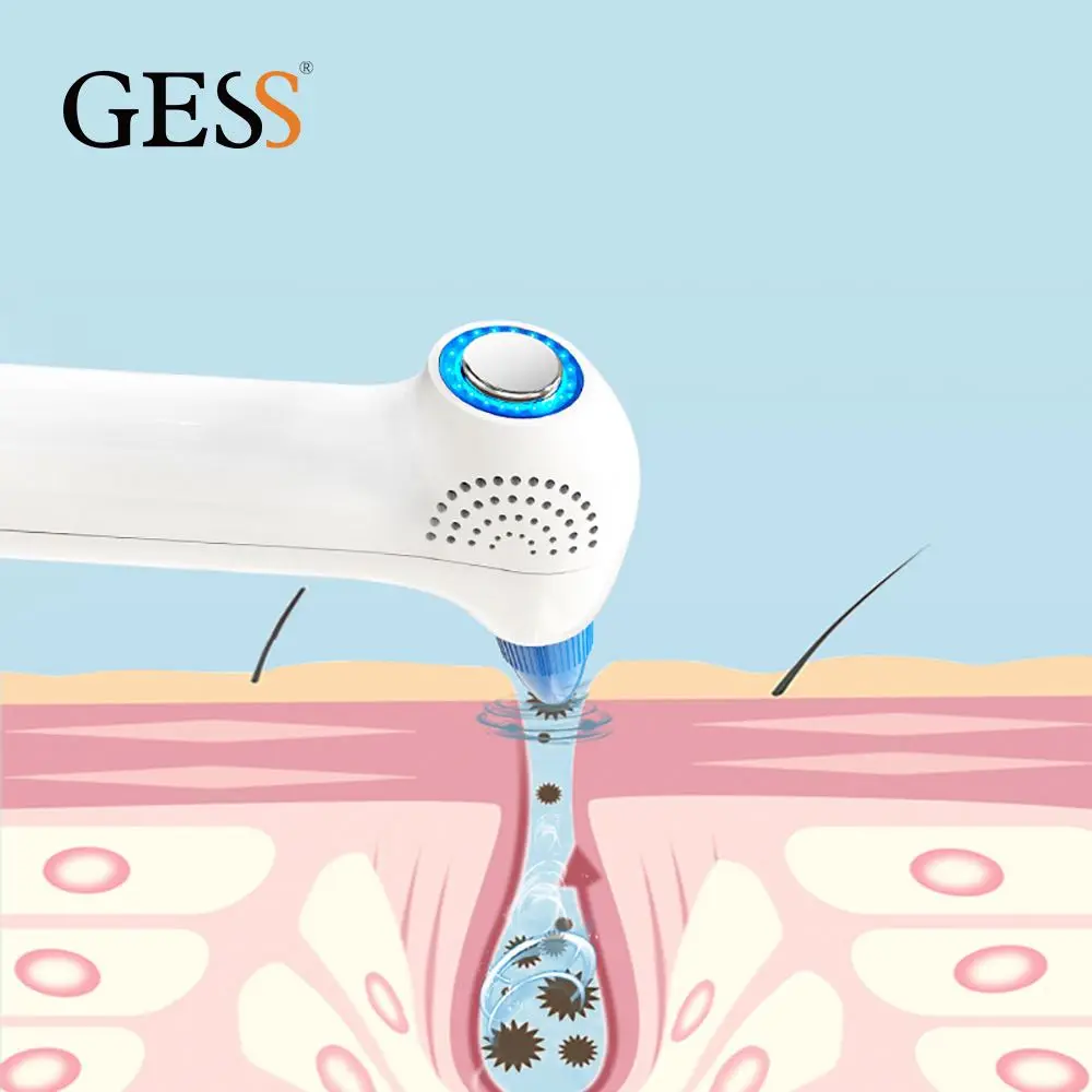 

New Arrival Vux Blackhead Remover Small Bubble Import Vacuum, White