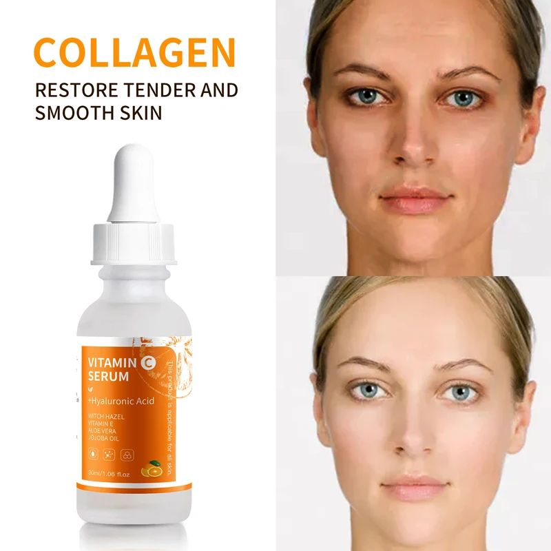 

Anti Aging Boost Skin Collagen Premium 20% Vitamin C Serum For Face with Hyaluronic Acid