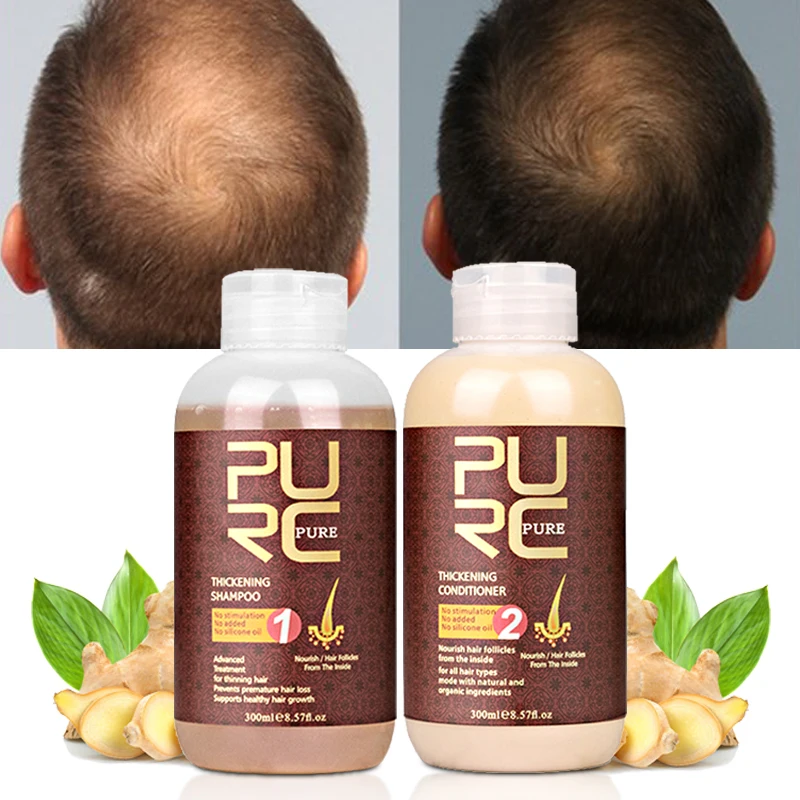 

Private Label Natural Organic Hair Care Growth Hair Treatment Anti-fall Ginger Prevent Hair Loss Shampoo and Conditioner Set