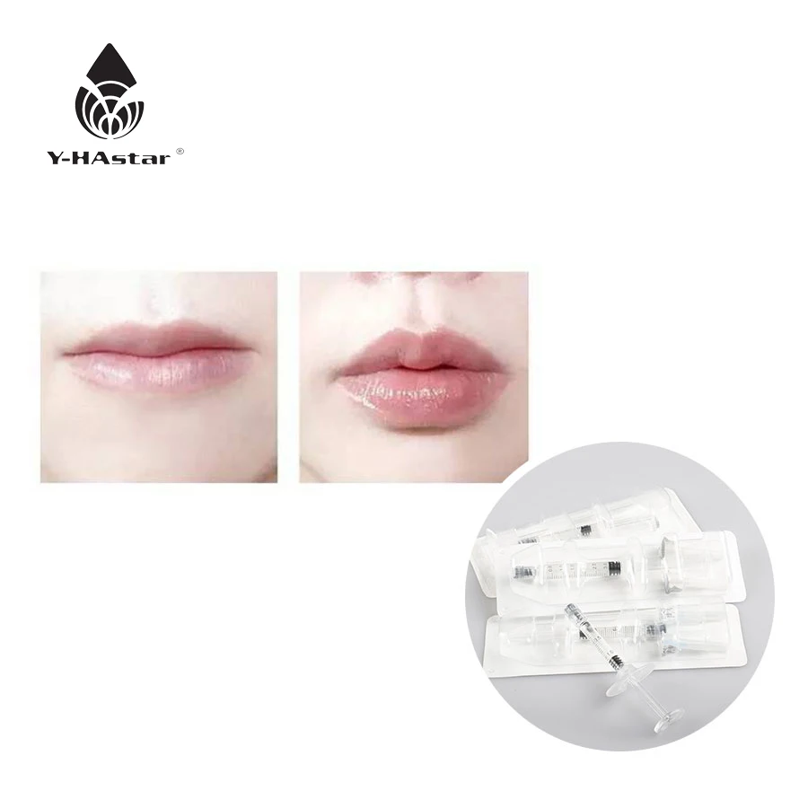 

Hot Sale Cross Linked hyaluronic acid dermal filler for lips enhancement with 2ml, Transparent