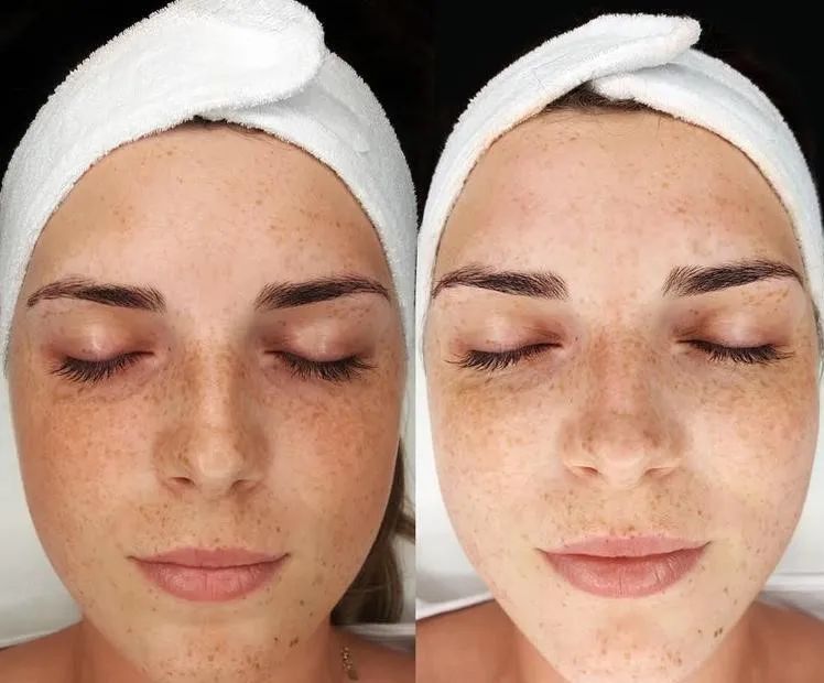 

BB Online Course | BB Academy