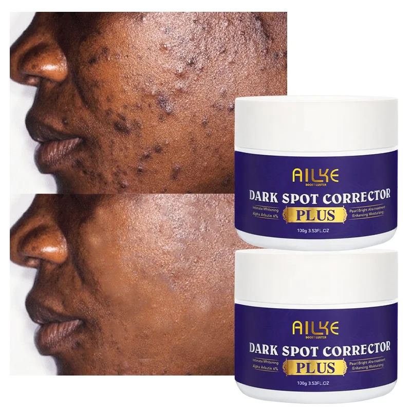 

Ailke Black Spot Removal Lightening Body Strong Bleaching Whitening Face Cream Lotion For African Skin