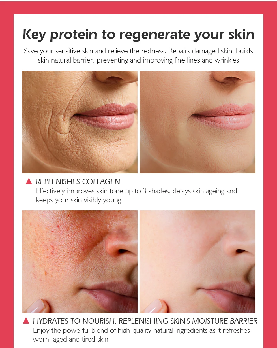 skincare ingredients that reduce redness