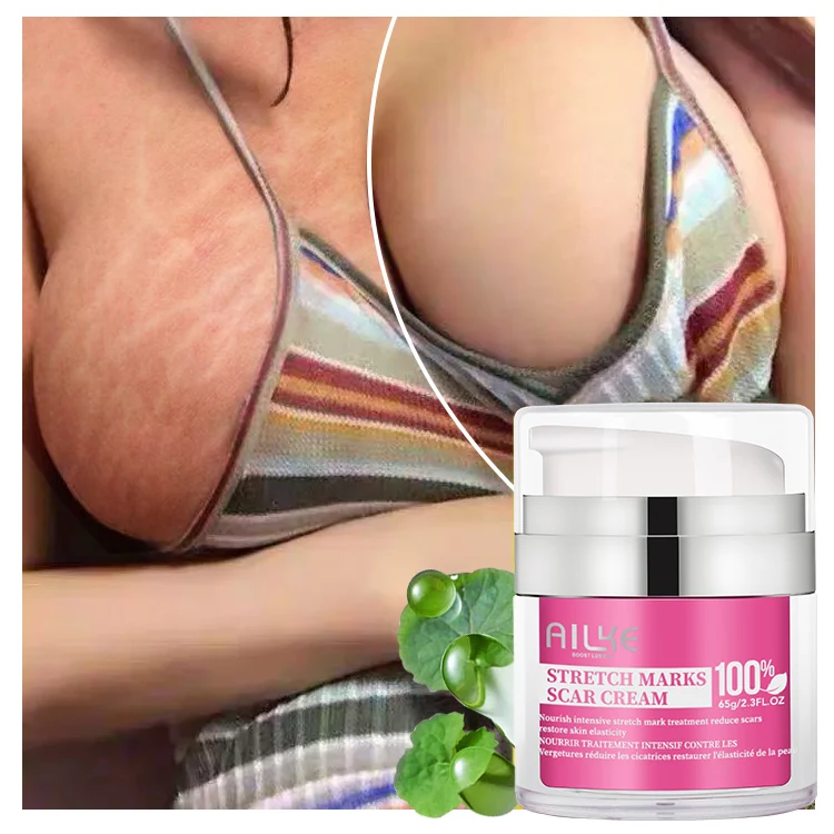 

100% Effective Best Collagen Jojoba Oil Stretch Mark Cream Removal Scar Cream Nourish Intensive Treatment Stretch Mark Cream