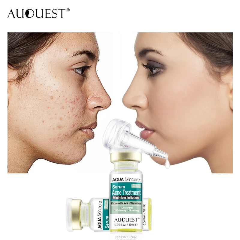 

Factory AuQuest Natural Serum for Clearing Severe Acne Breakout Remover Pimple and Repair Skin Acne Treatment extract oil Serum