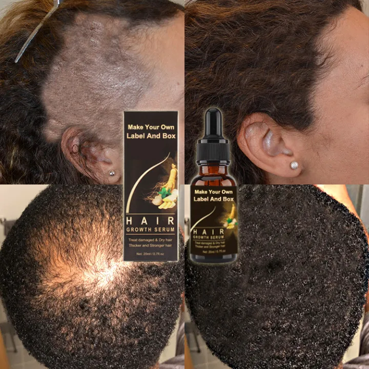 

Custom Logo Ginger Hair Care Treatment Anti Loss Regrowth Scalp Elixirs Hair Growth Oil Serum