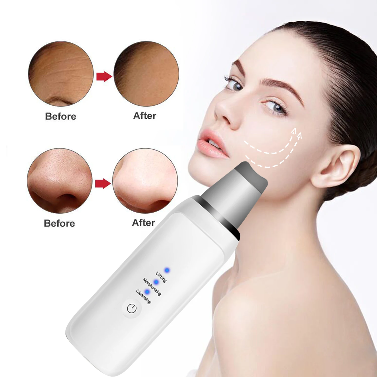 

2019 Wholesale Hand Hold Ultrasonic Face Cleaner Professional CE RoHs FDA approved Microcurrent Ultrasonic Skin Scrubber, White/customed