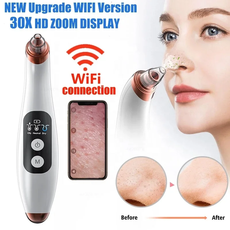 

Visible Black Head Removal Removedor De Cravos Remove Blackhead Dropship Acne Treatment CE Blackhead Remover Vacuum with Camera