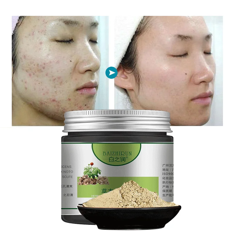 
OEM/ODM private label customized Chinese herbaceous plant Acne treatment remove medicine powder/glay skin care facial mask 