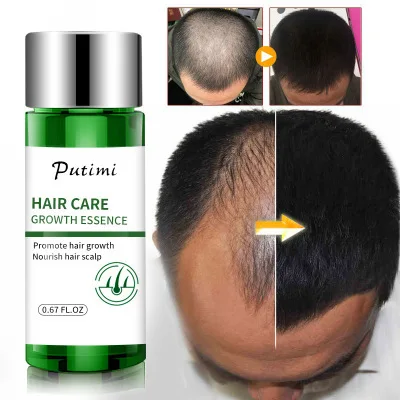 

Wholesale Hair Growth Oil Fast Hair Growth Nutrition Scalp Hair Care Growth Serum