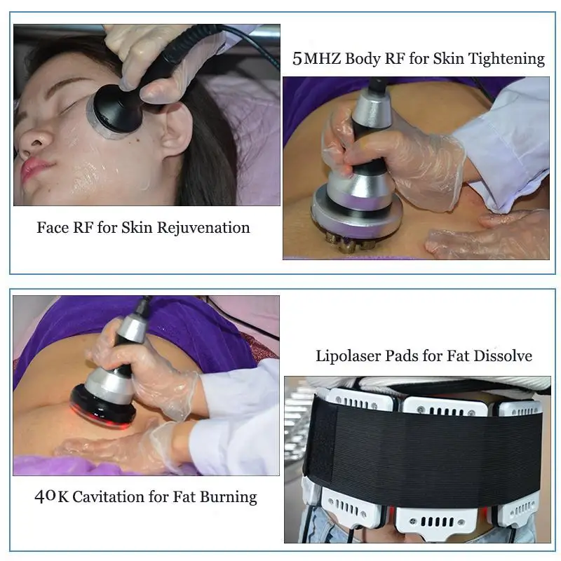 New cryolipolysis 360 degree cryo fat freezing machine portable cryolipolysis slimming machine with cavitation rf handles