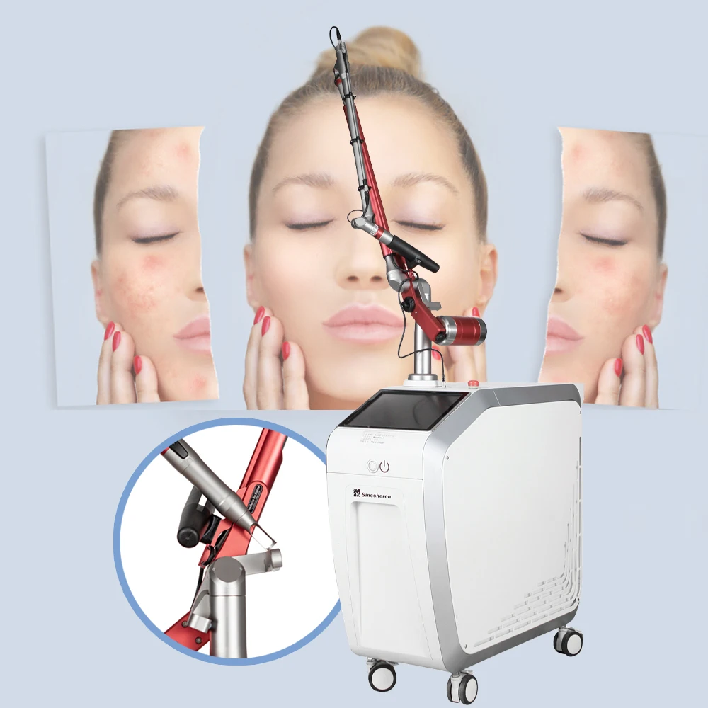 

2021 Hot Sale Professional 450Ps 1064nm 532nm Picosecond Laser Q Switched Nd Yag Laser Tattoo Removal Machine price