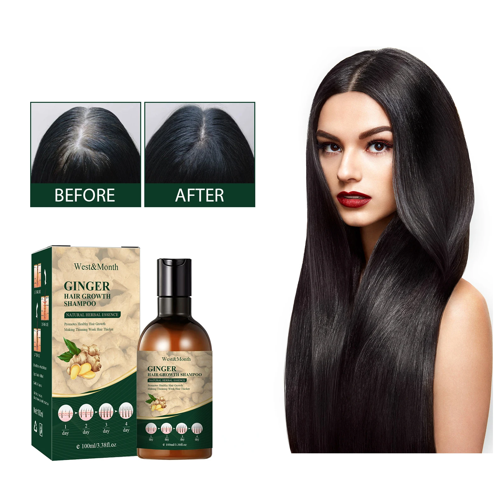 

West&Month Hair Growth Shampoo Conditioner Thickener Anti Hair Loss Products Grow Hair Regrowth Scalp Treatment Serum Oil 100ml