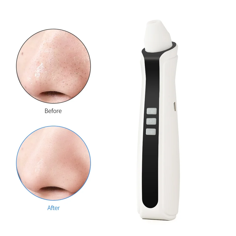 

visual blackhead remover vacuum pore cleaning acne remover blackhead remover