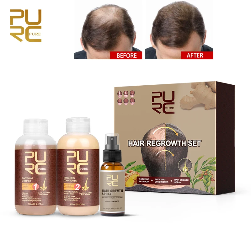 

Magic Natural Herbal Coconut Oil Hair Growth OEM Ginger Faster Bald Hair Serum Growth Stimulating Oil Products For Men