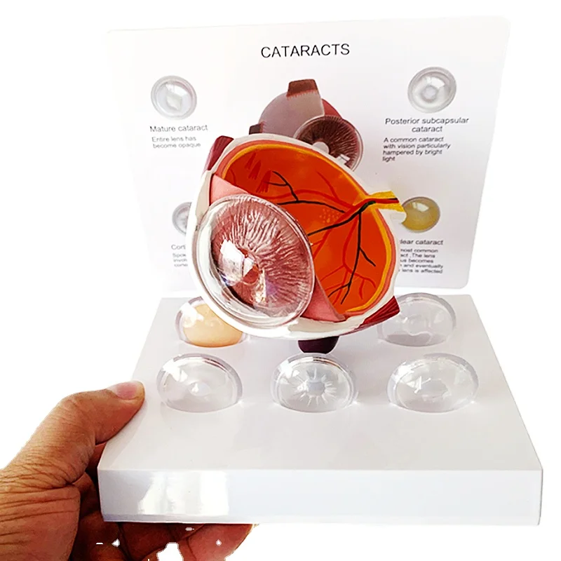Medical Teaching Human Eye Cataract Anatomical Model