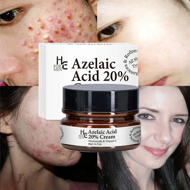

China Factory Wholesale Custom 30g Private Label Natural Organic Face Care Refine Pores Acne Treatment Azelaic Acid 20% Cream